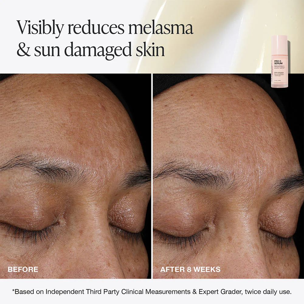 Pro C Serum - Image 5